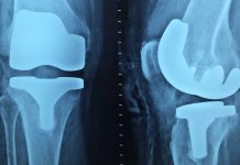 Advantages of Using Cloud-Based Medical Software Advantages-of-Cloud-Based-Medical-Software-on-FocusEverything