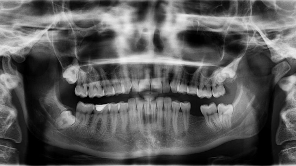 Medical-Diagnostic-Imaging-on-FocusEverything