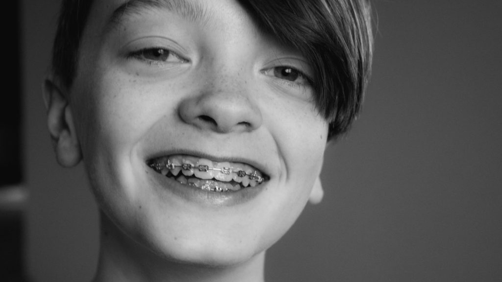 When-You-Want-To-Remove-&-Replace-Your-All-Teeth-on-focuseverything